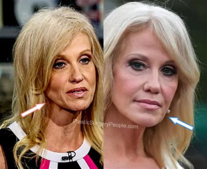 Conway Plastic Surgery Before And After