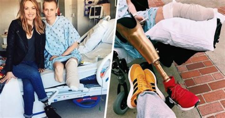 Lauren Wasser loses second leg to toxic shock syndrome