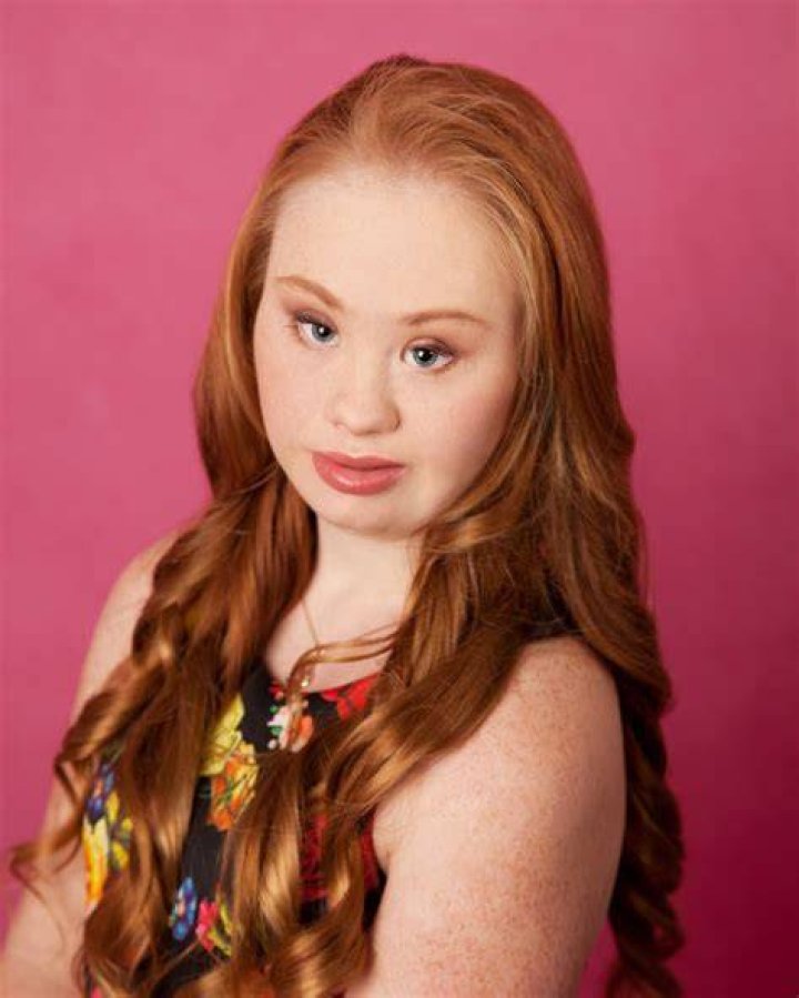 Model with Down Syndrome Madeline Stuart Hospitalized for Heart Failure