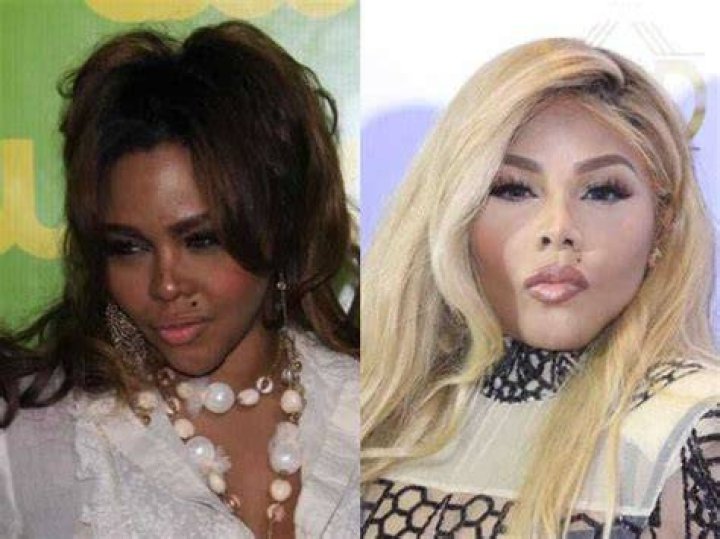 Skin Bleaching Unveiled In Celebrity Culture