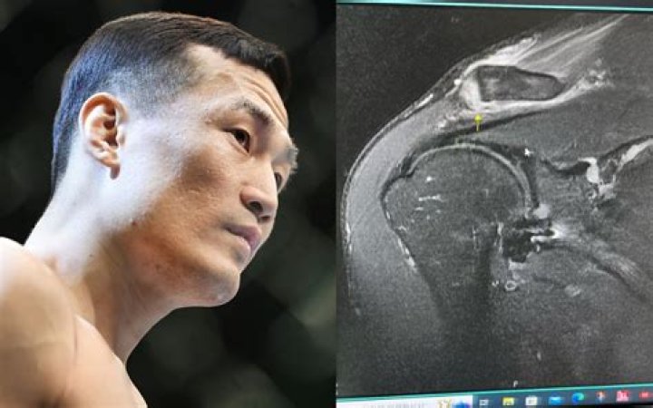 The Korean Zombie injures shoulder, out of UFC Seoul Asian MMA